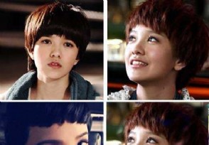 郭采洁菜花病是真的吗 郭采洁菜花病传闻