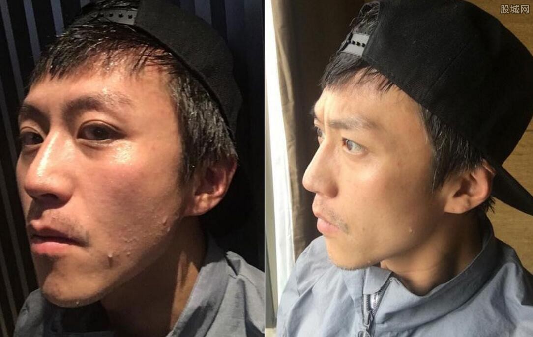 邓超白发原因