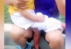 3岁男童路遇烈犬挣脱狗绳撕咬 狗将孩子扑倒疯狂撕咬