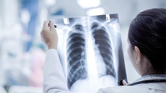 重症白肺死亡率40%以上
