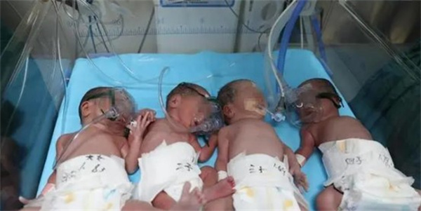 女子诞下四胞胎后又怀四胞胎 四胞胎妈妈回复是家族遗传