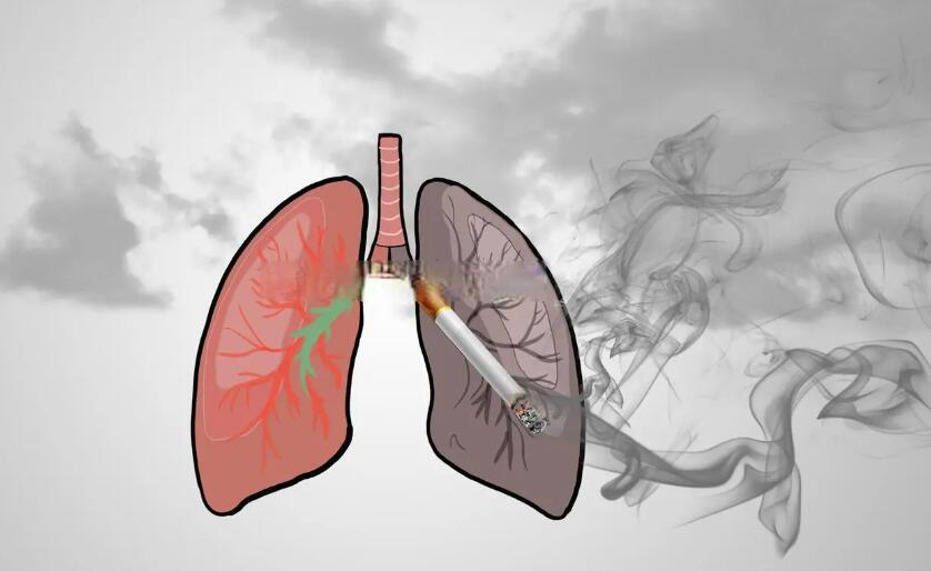 29岁小伙一天一包烟确诊肺癌 年轻人该如何预防肺癌？